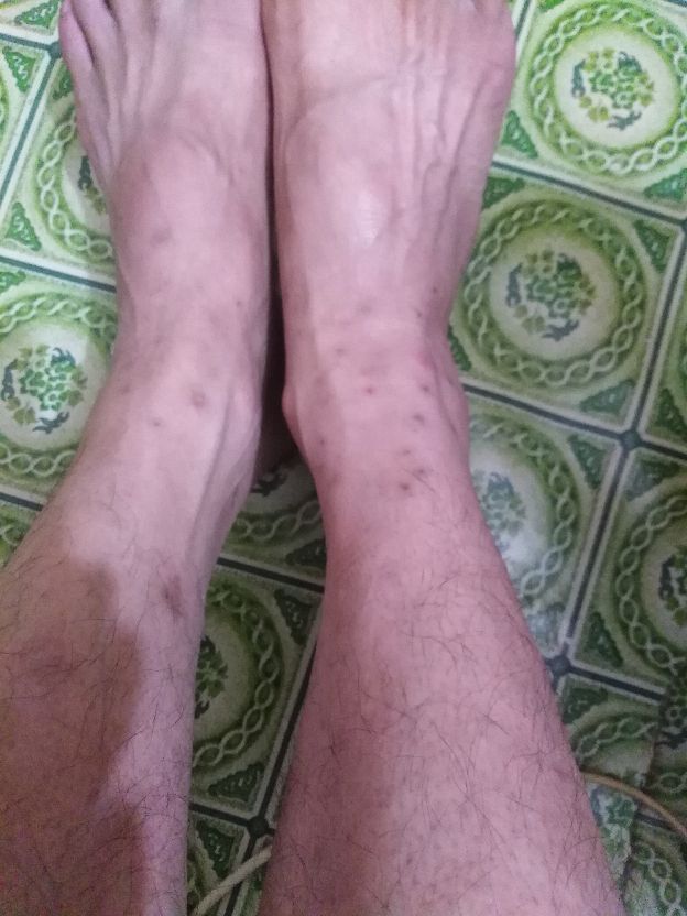 红火蚁怎么做才好吃,消灭红火蚁的最佳配方