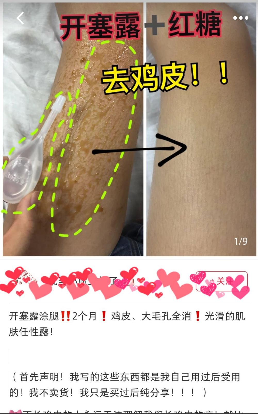 网红的护肤有多假,网红护肤产品的危害