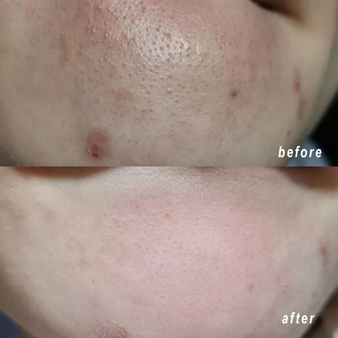 清洁面膜测评,清洁面膜测评打假