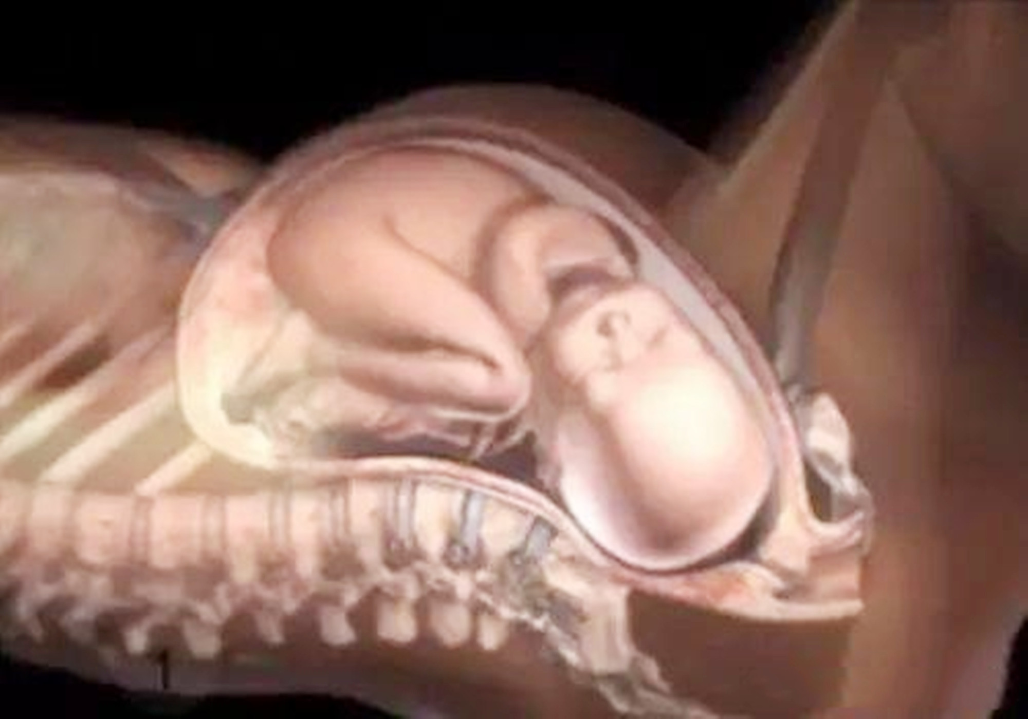 顺产痛感的“关键所在”，三张图透彻解析，看完心疼顺产妈妈