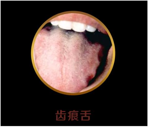 如何通过舌苔判断宝宝健康,中医教你从14种舌头的舌象看健康