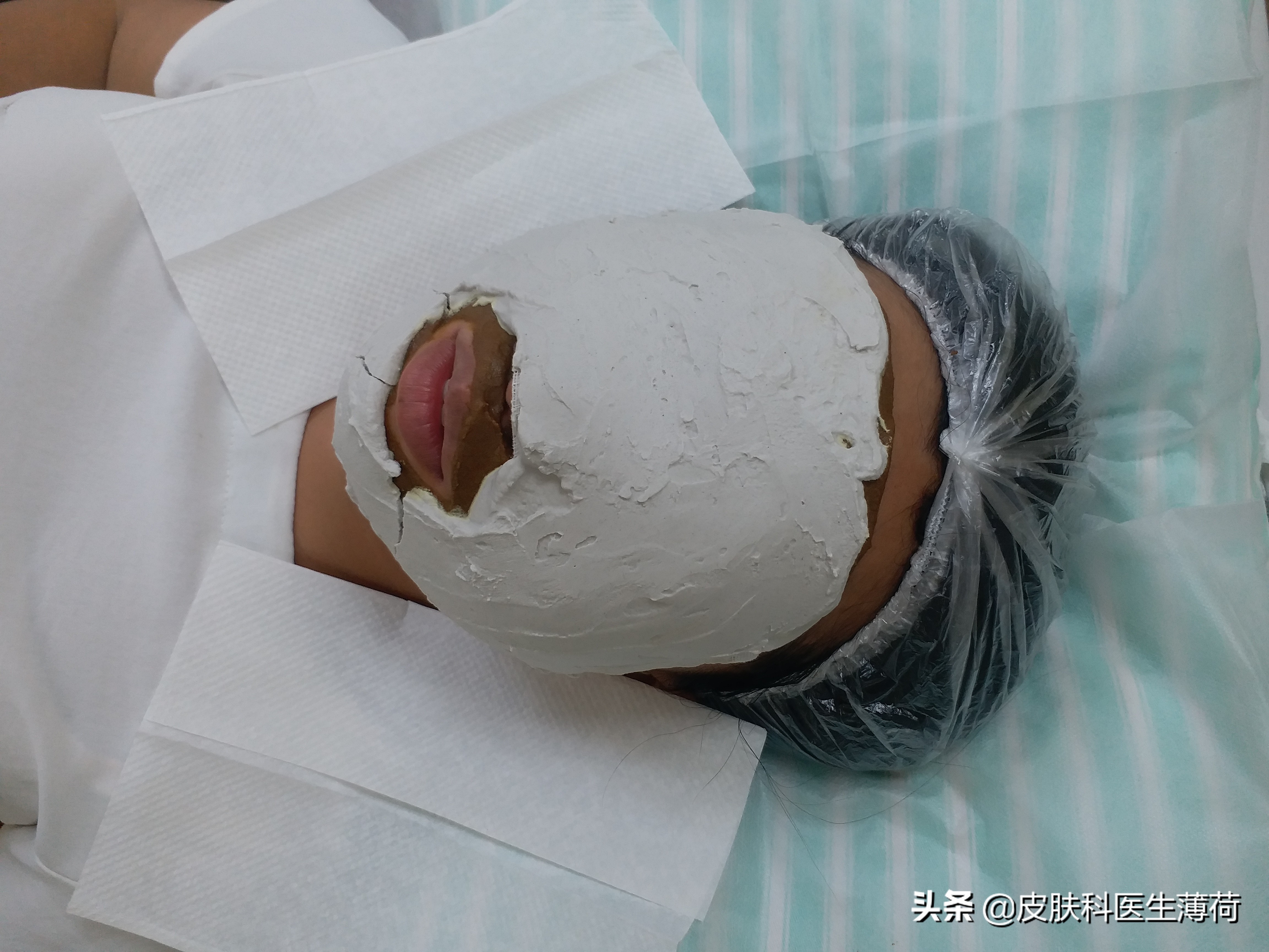 皮肤科祛痘不留印,皮肤科医生不留疤痕的秘诀