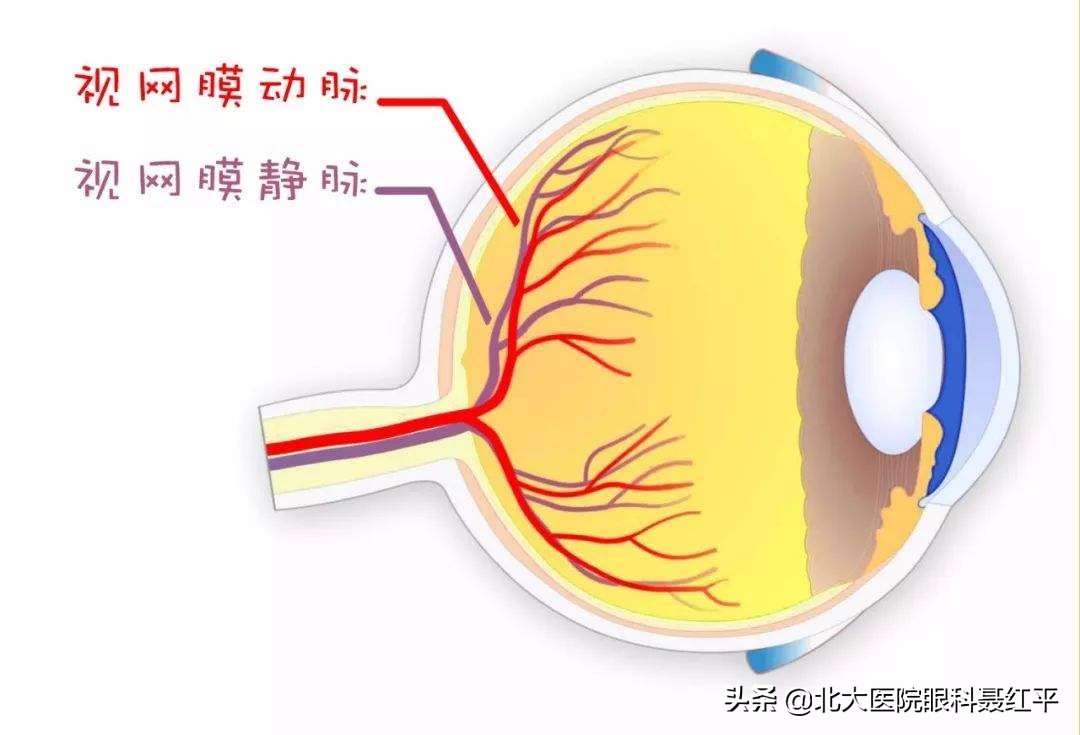 反复发生一过性视力下降、黑蒙，当心“眼梗”