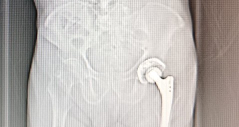 贲门癌吐血抢救,中国最著名的贲门癌治疗专家