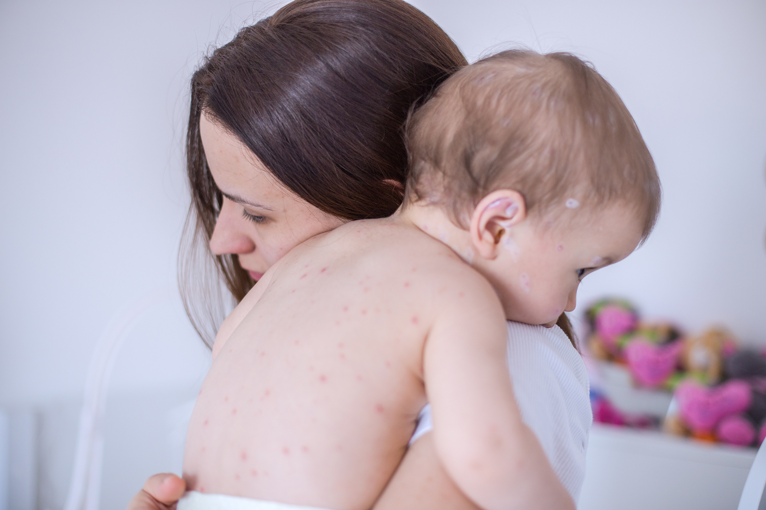 夏季蚊虫叮咬止痒的植物,蚊虫叮咬夏天如何防止