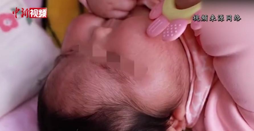 官方通报大头娃娃激素婴儿霜,婴儿霜激素大头娃娃后续