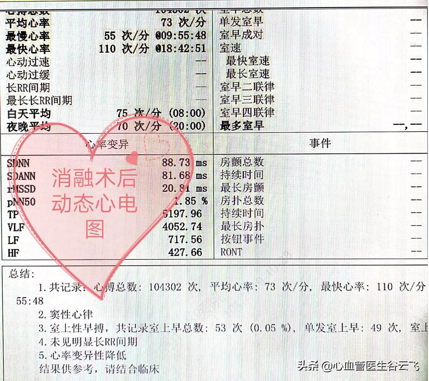 心律失常频发房性期前收缩,心律失常门诊故事