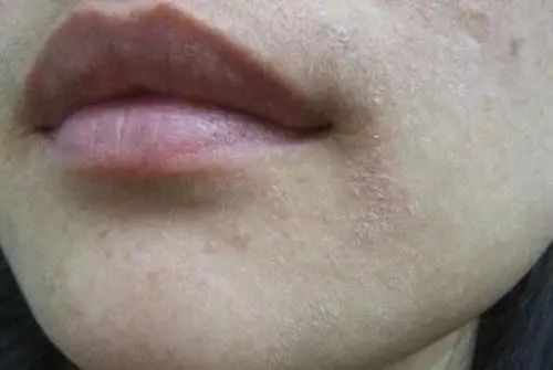 春天怎么样降火去燥,春季降燥方法