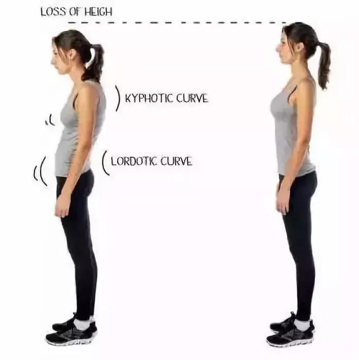 改善脖子前倾的动作视频,脖子前倾毁了无数人3个动作