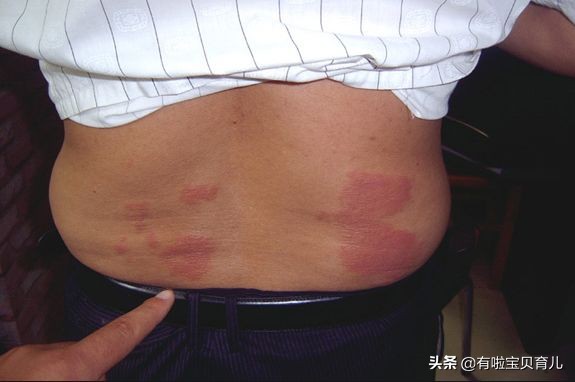 葵花远红外小儿止咳贴贴法示意图,宝宝止咳贴的做法