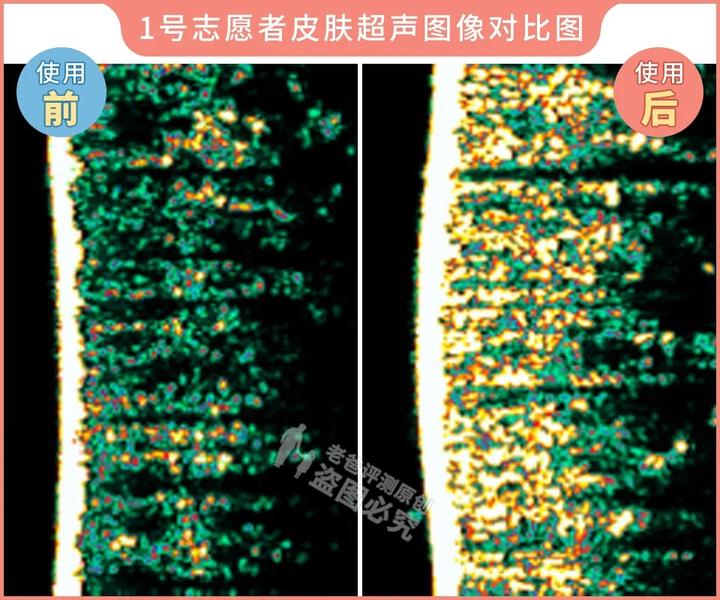 测评家用美容仪真的有用吗,网红推荐的美容仪有用吗