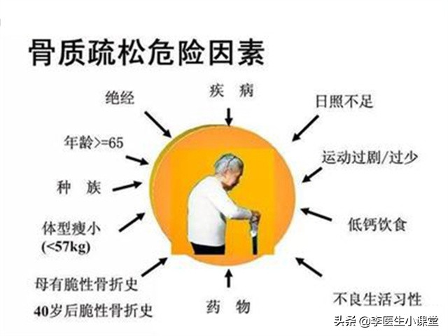 出现这3种症状你被骨质疏松盯上,骨质疏松有哪些症状就要赶快治疗