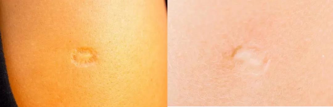 清醒一点，你胳膊上从小就有的那个疤痕，不是被神选中的印记