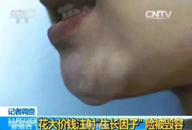 egf修护原液是干嘛的,egf修复冻干粉