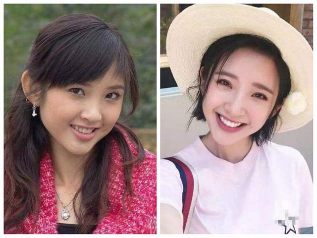 微整形美白针,微整形是永久的吗