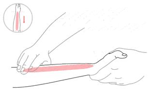 黄疸的小儿推拿手法,小儿吐奶推拿法