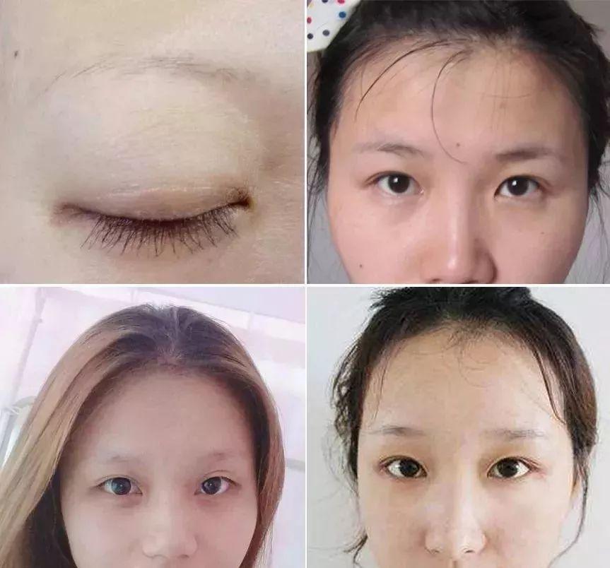 残眉,眉毛稀疏救星轻松拥有野生眉