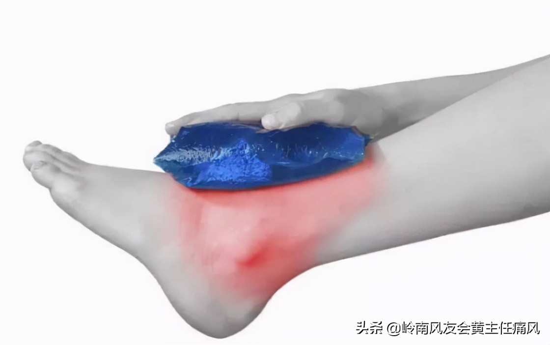 痛风夜间发作的原因及缓解方法,痛风拿冰敷能缓解疼痛感吗