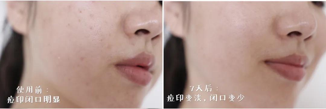 死海泥洗面膜怎么样,死海泥面膜的神奇功效是什么