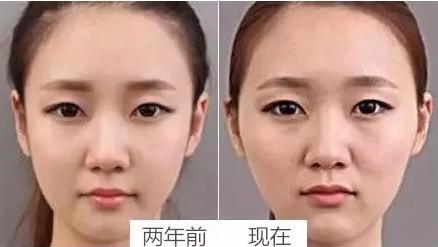 霍建华变胖视频,为什么霍建华老了就油腻了