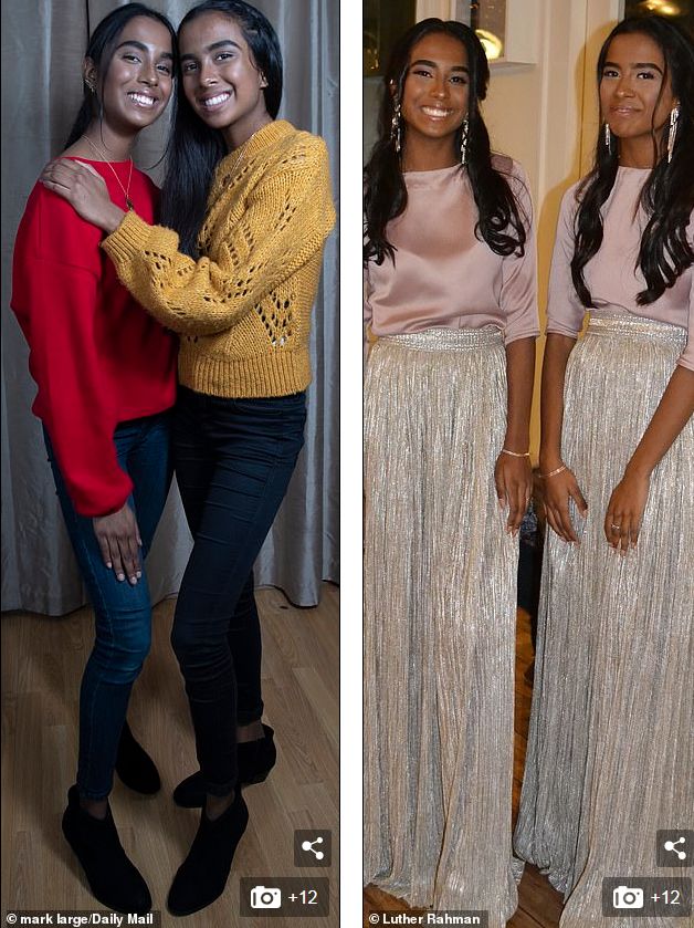 这对要上牛津剑桥的姐妹花,16年前是连体婴!存活率仅百万分之一