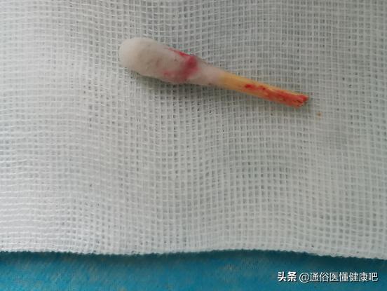 少年血尿是什么原因引起的,少年血尿是怎么回事