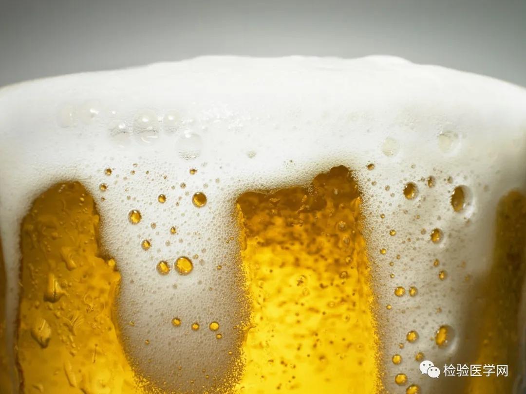 尿里有大量的啤酒花泡沫什么原因,尿里飘一层油花是什么原因