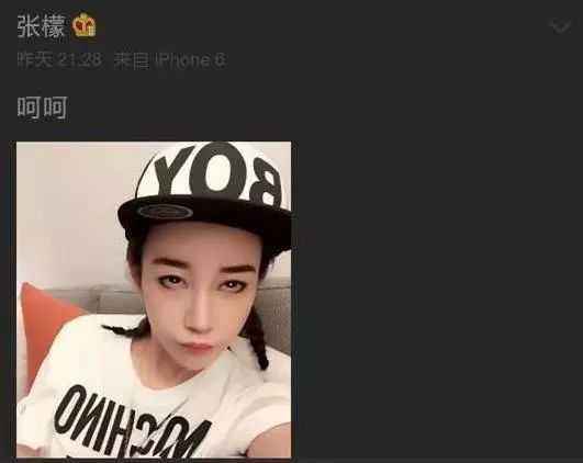 张檬节目中勇敢自曝整容黑历史,张檬整容失败的故事