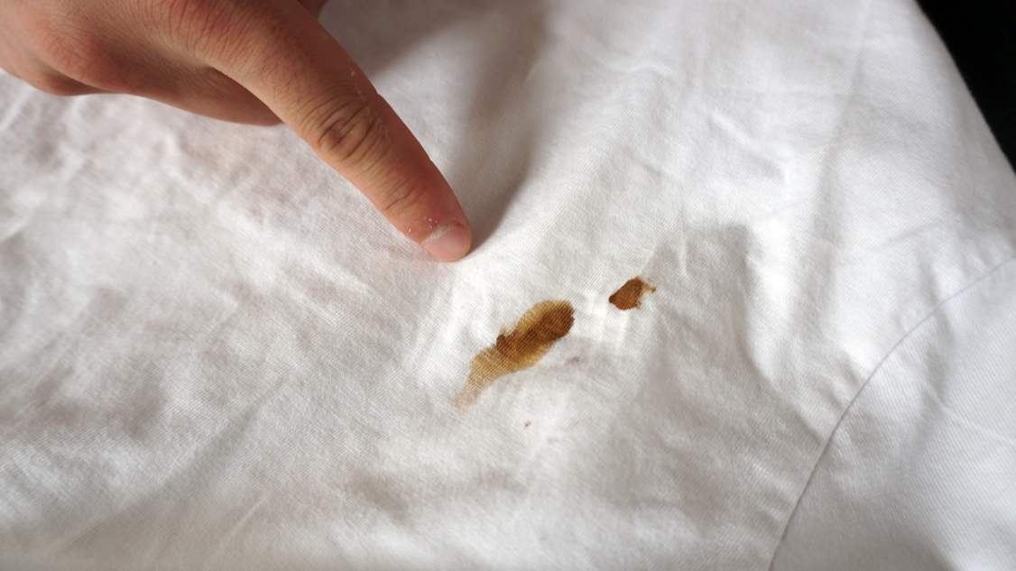 用84怎么去除白衣服上的顽固污渍,棉白衣服上的污渍怎么去除小窍门