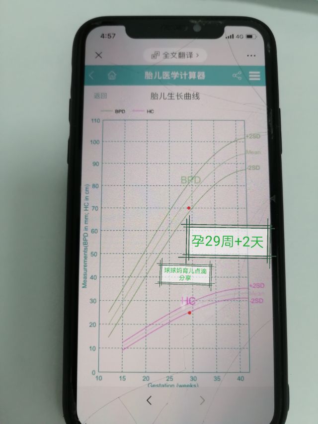 宝宝b超显示小了5天,宝宝b超偏小3周预产期会推后吗