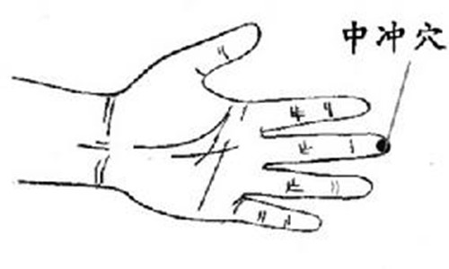 打嗝有多种情况引起,打嗝的病理原因