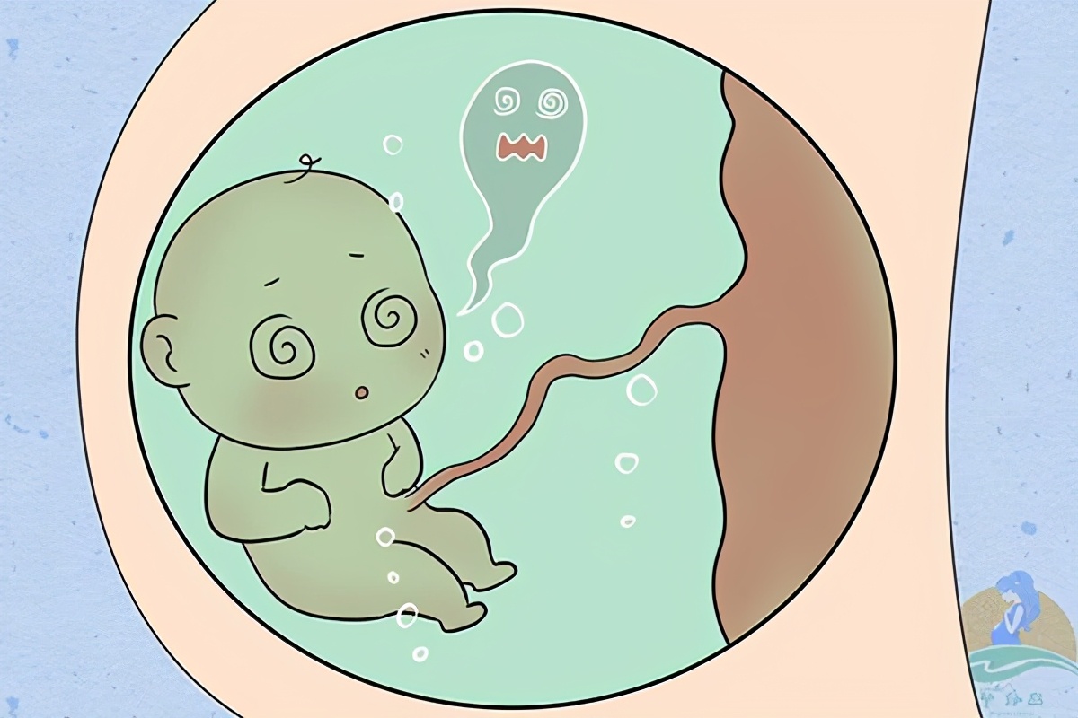 孕妇羊水浑浊对孩子有什么影响,孕期羊水不好怎么办