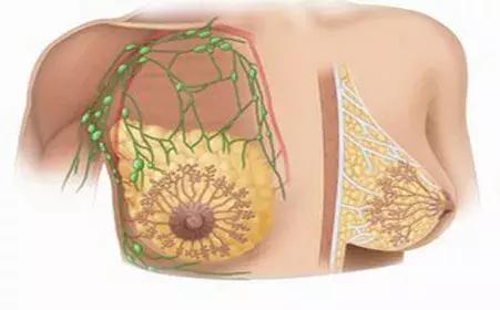 乳腺增生结节乳房胀痛胳膊酸麻,乳腺增生导致的乳房肿块如何消除