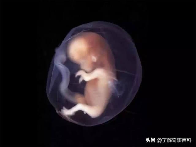 孩子头顶太多旋,孩子头顶有2个旋到底代表啥