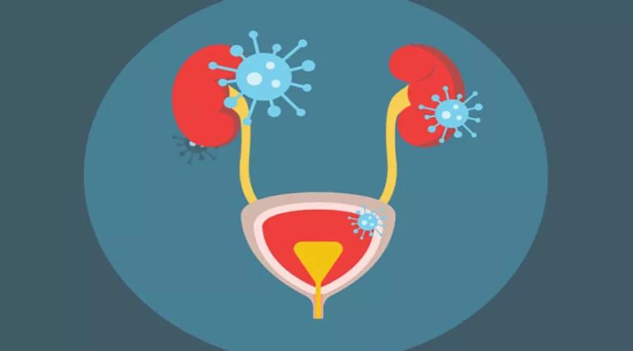 男孩尿液混浊的原因,吃鱼后尿液混浊是什么原因