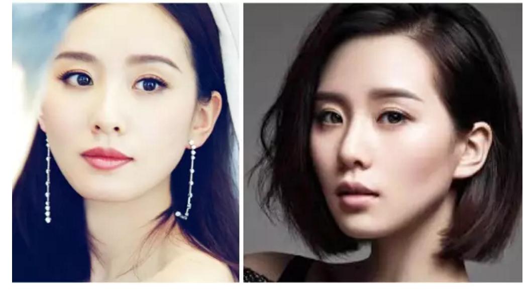 少年法令纹和痘坑显老,显老元凶法令纹