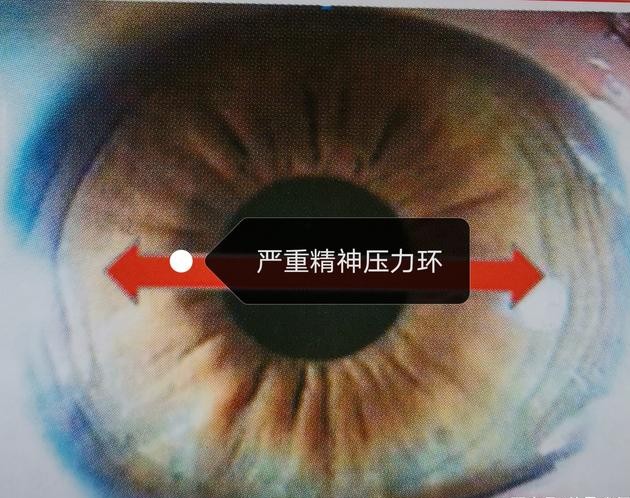 猫得了抑郁症，如何治疗？