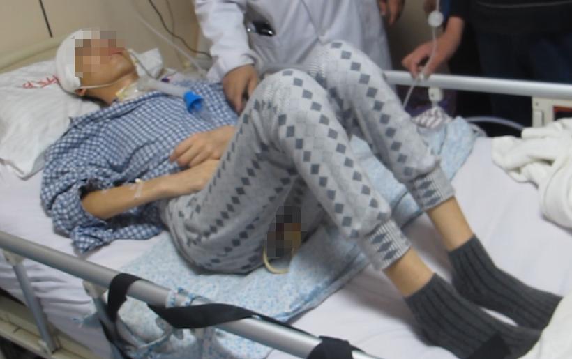 开颅手术后颅内细菌感染图片,外伤开颅手术后脑积液能恢复吗