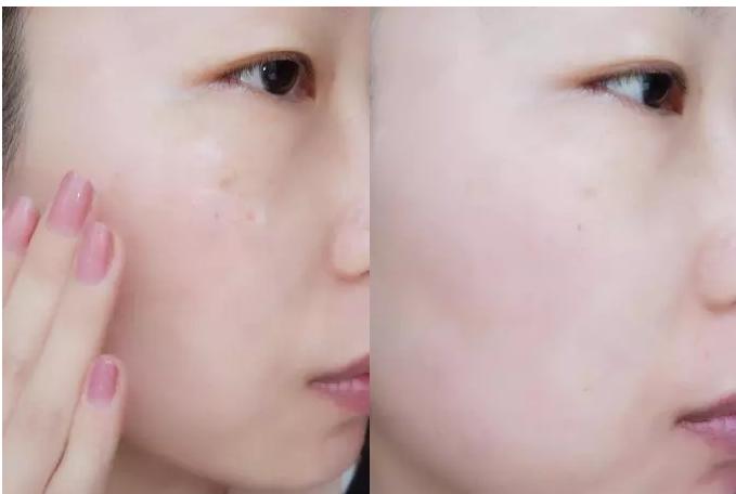 虾青素推荐新西兰,平价虾青素抗老精华