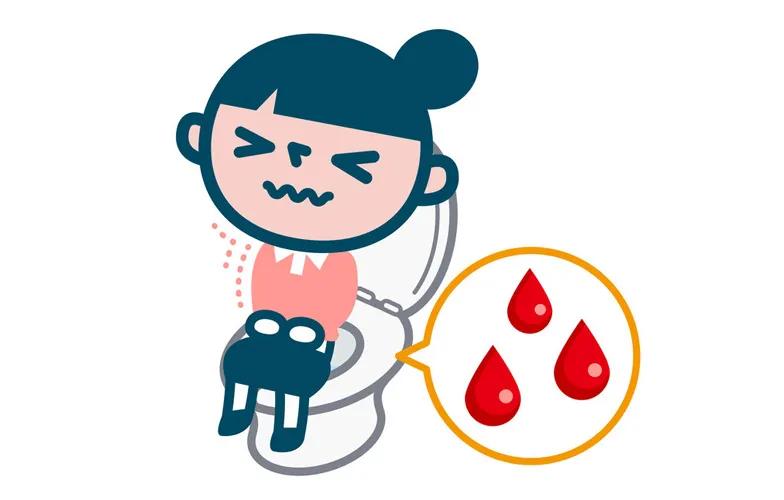 痔疮反复发作别拖试试这个好方法,痔疮发作是什么感觉