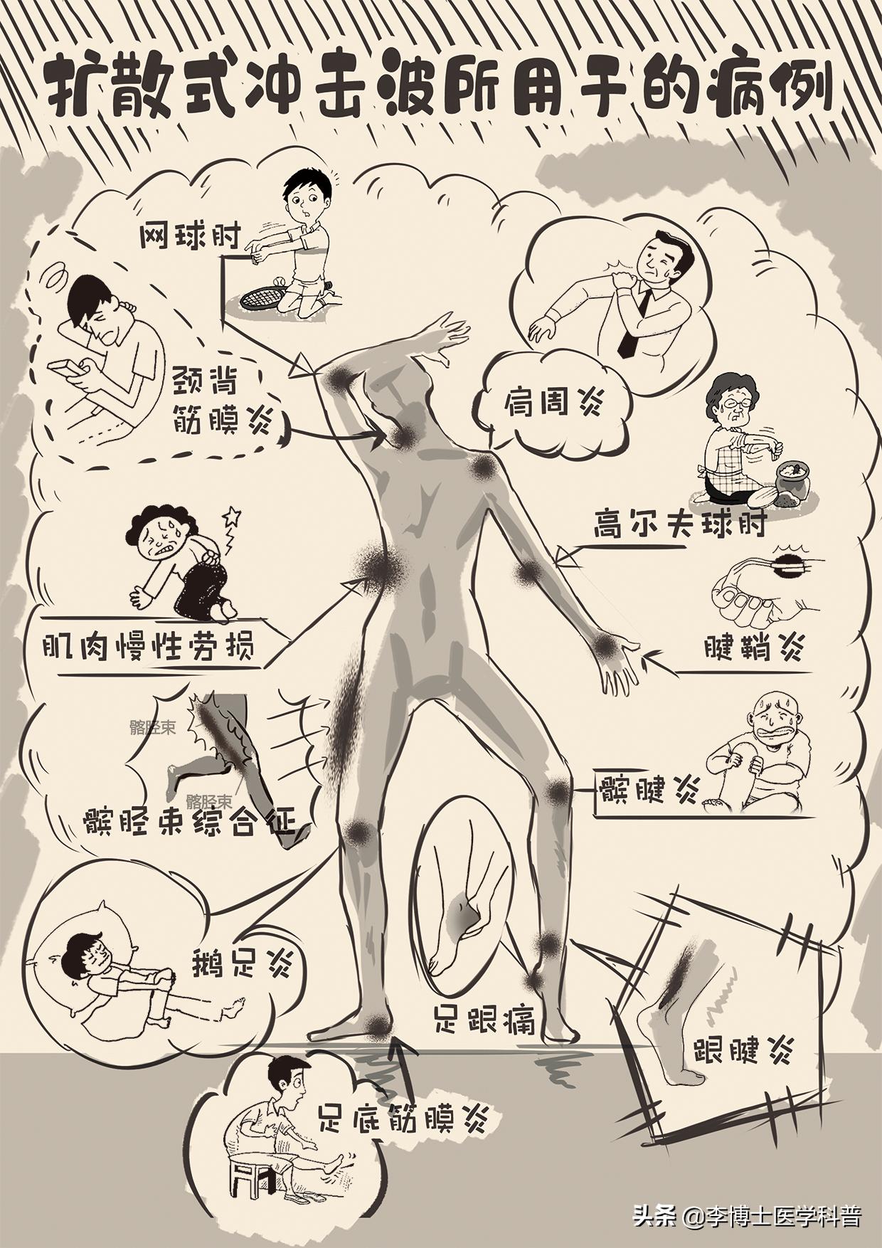 如何让膝盖咔咔响一招解决,膝关节咔咔响如何保护动作视频