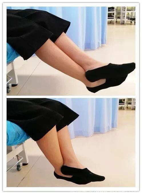 髌骨骨折康复后会留哪些后遗症,髌骨骨折手术康复训练视频动作