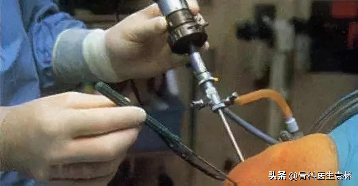 膝关节不受控制的抖动什么原因,膝盖一扭动就疼是什么原因