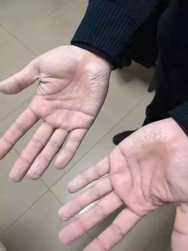 直击一线现场视频,直击医院现场