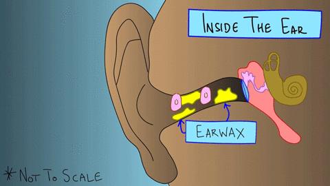 用棉签掏耳朵的危害动画,用棉签掏耳朵对身体有害吗