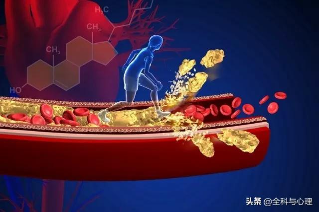 你生命中不可承受的肥胖危机,你生命中不可承受的肥胖危机内容