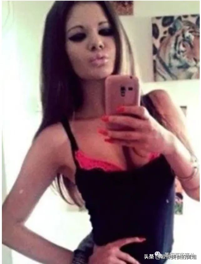 20次整容成功的女人,22岁女人做20次丰唇手术