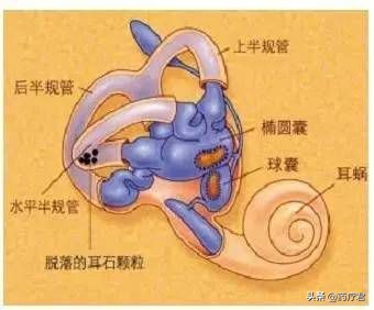 耳朵里面石头掉下来什么意思,耳朵里的石头掉下来了好晕