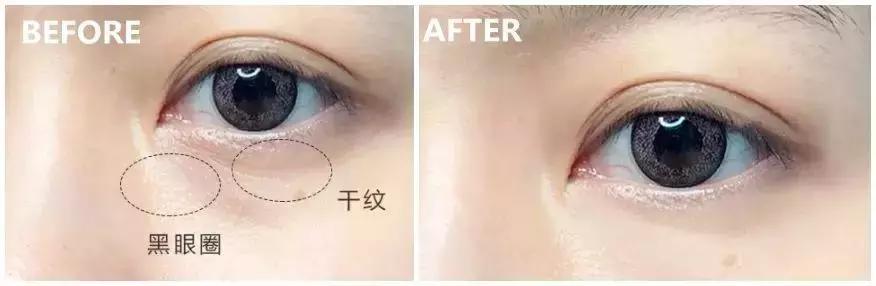 护肤反而皮肤差,改掉这些护肤恶习让你越变越美丽