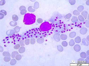 黑热病防控指南,河南黑热病的主要流行区
